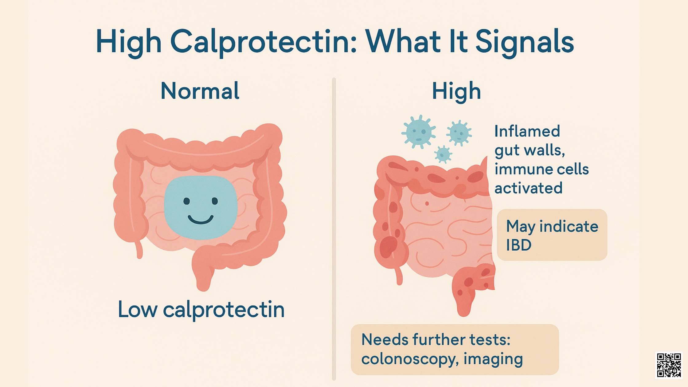 What High Calprotectin Means