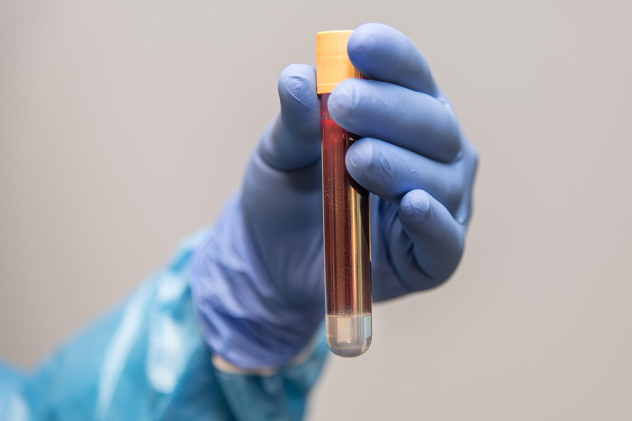 Early Warning Signs of Inflammation That Show Up in Routine Testing ...